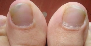 Anerer sprooch liesen